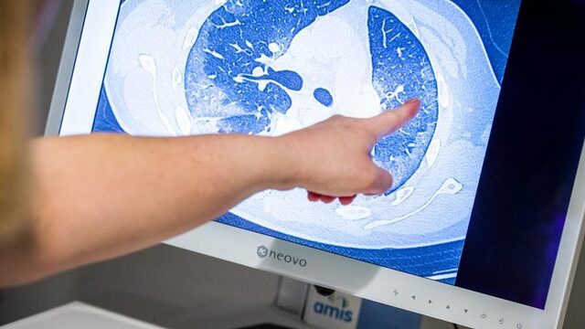 Pathologen zien meer dan alleen longontsteking bij overleden coronapatiënten