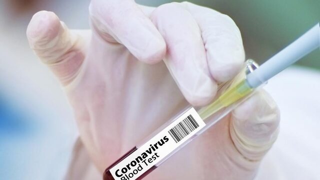 Kans op vaccin tegen corona is groot, maar het kan ook mislukken