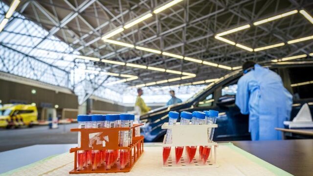 Hoe werkt de E-nose coronatest en wat hebben we er in de toekomst aan?