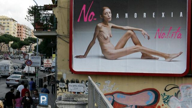 'Praat niet over, maar praat mét anorexiapatiënten’