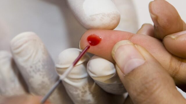 Wat kun je doen aan een hoog cholesterolgehalte?