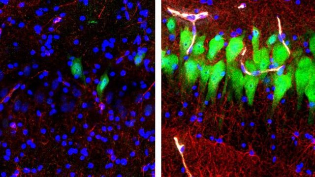 Fact check: kunnen dode hersenen echt weer actief worden?