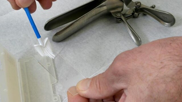 Vrouwen positief over bevolkingsonderzoek naar baarmoederhalskanker, maar deelname loopt terug