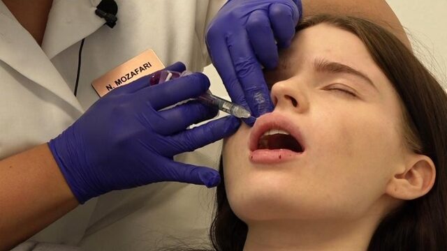 Jongeren gebruiken botox en fillers om Instagram-filters na te bootsen