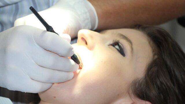 Wil je een goed gebit? Let dan op deze 5 aandachtspunten