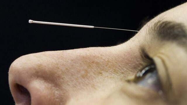 Alternatieve therapieën blijven vergoeden? 'Ik betaal ook mee aan rokers'