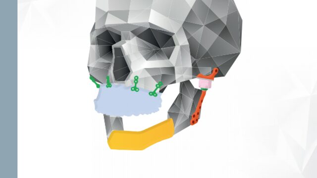 Jonge doctor: 3D-technologie en een nieuw beroep in de medische wereld