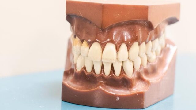 Hoogleraar trekt aan de bel: mondzorg bij kwetsbare ouderen vaak vergeten