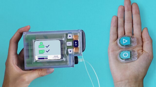De kunstmatige alvleesklier neemt de zorg van mensen met diabetes type 1 uit handen