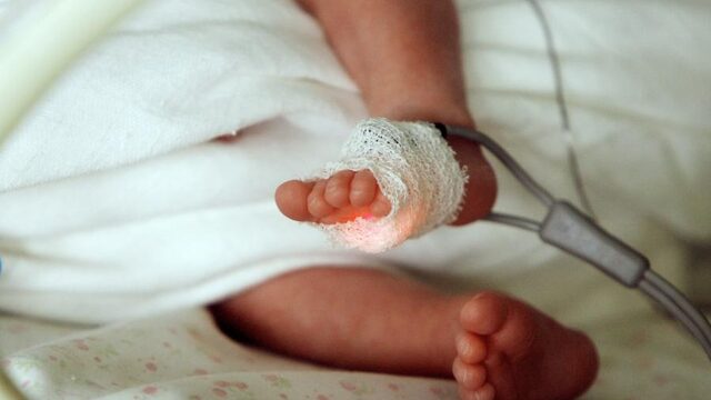 Zorgen om volle intensive care pasgeboren baby’s