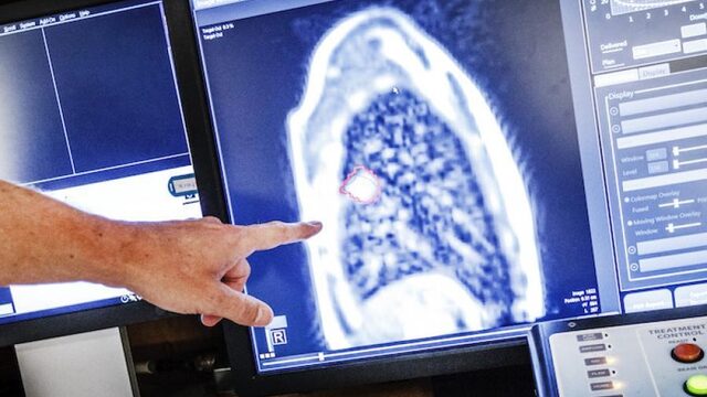 Zeldzame kankersoorten te vaak te laat ontdekt, KWF investeert miljoenen om diagnose te verbeteren