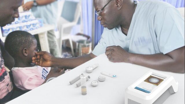 Miljoenen besmet met schistosomiasis. Waarom bestaat deze ziekte nog?