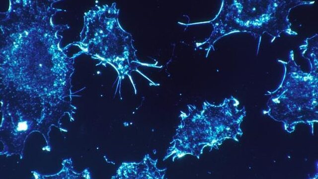 Dit is hoe immuuncellen kanker bevechten