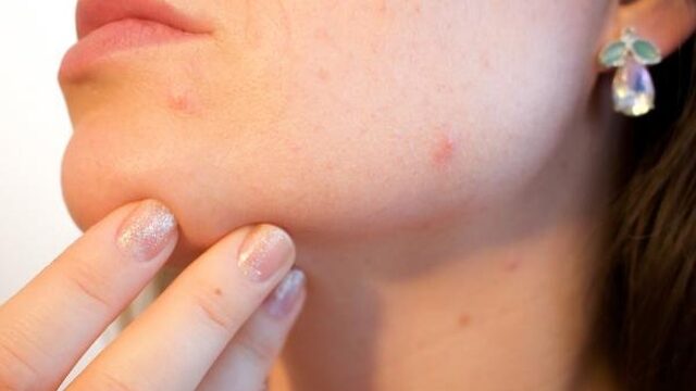 In vijf uur een beeld van alle ziekmakende bacteriën op je lichaam