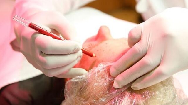 'Kwetsbare mensen worden bij RTL ingezet voor een commercieel gewin'