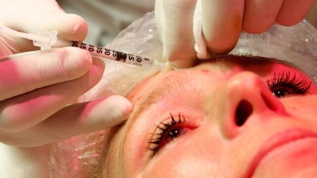 Beautyvloggers met fillers: 'Ze doen alsof het gaat om het halen van een krentenbol'