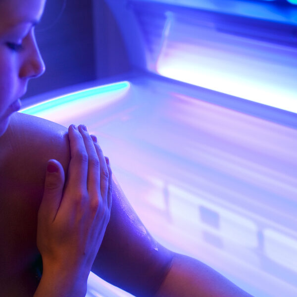 Isabel kreeg op haar 21e huidkanker: 'Ik ga nooit meer onder de zonnebank'