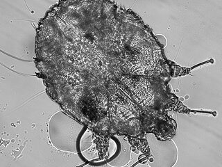 Schurft komt steeds vaker voor: waarom de behandeling soms lang kan duren