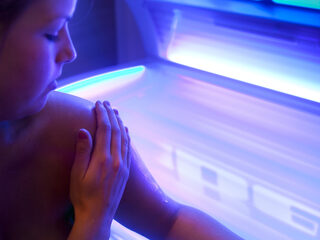 Isabel kreeg op haar 21e huidkanker: 'Ik ga nooit meer onder de zonnebank'