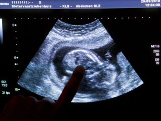 Prenatale screening (NIPT) wordt gratis: 'Maar weet waar je voor kiest'