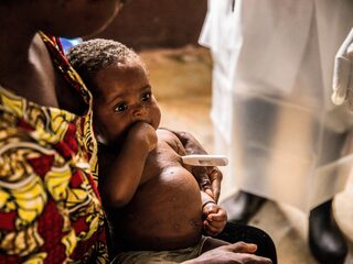 Apenpokkenvirus landt in Europa: hoe gaan we straks om met ziekenhuisopnames?