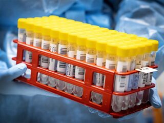 RIVM: omikronvariant al eerder in Nederland dan tot nu toe gedacht