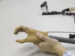 Oekraïense oorlogsslachtoffers dragen Nederlandse handprothese iGrip