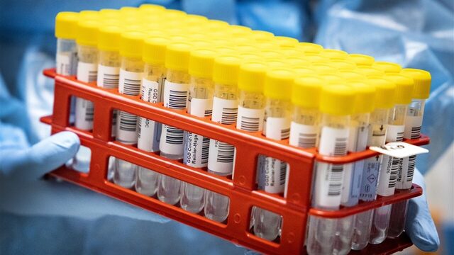 RIVM: omikronvariant al eerder in Nederland dan tot nu toe gedacht