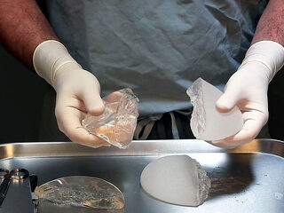 'Moeilijk om patiënten met bepaalde klachten te linken aan die borstprotheses'