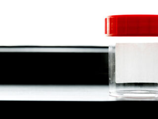 Podcast De Dag: 'Nog veel meer sjoemelende zaad-artsen'