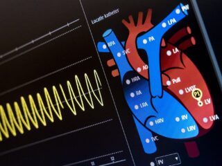 Erfelijke hartziekte op Ameland terug te leiden naar middeleeuwen