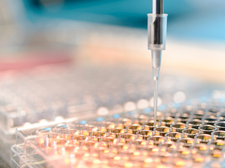 Neurologen: 'Zorg dat MS-patiënten stamceltherapie in Nederland kunnen krijgen'