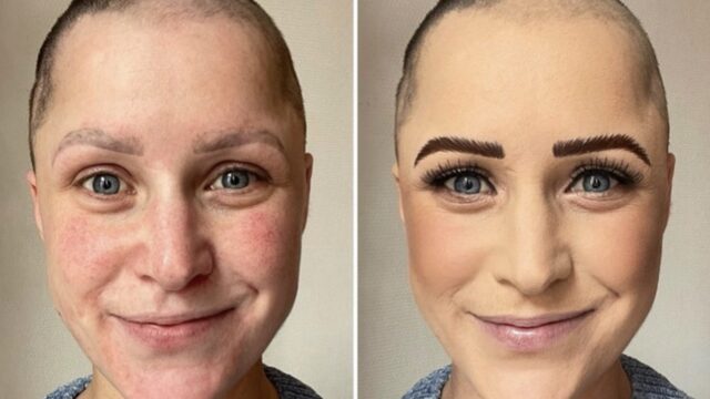 Veronique ging van een volle haardos naar kaal in 2 weken