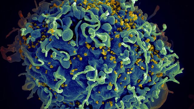 Zorgen om gevluchte Oekraïners met hiv