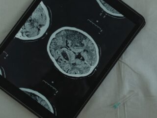 Wat epilepsie met je doet: 'Ik kreeg er een heel slecht zelfbeeld van'
