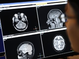 Muziek in hersengolven: Another Brick In The Wall van Pink Floyd te horen in brein