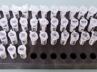 Veel haken en ogen aan landelijke DNA-databank