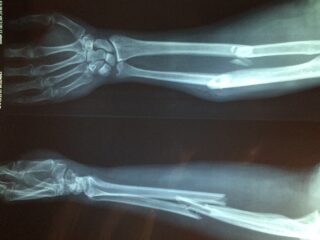 Nieuwe polikliniek voor musici met blessures