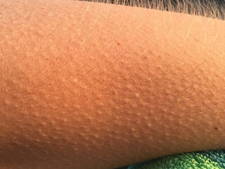 Waarom krijg je kippenvel van muziek?